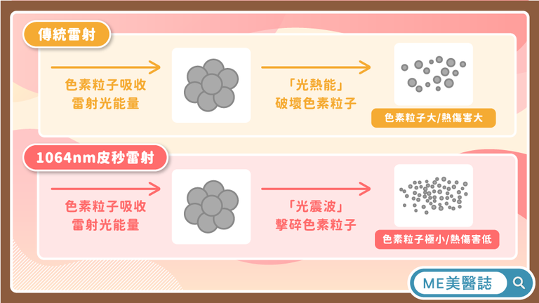 雷射除斑 保濕防曬 